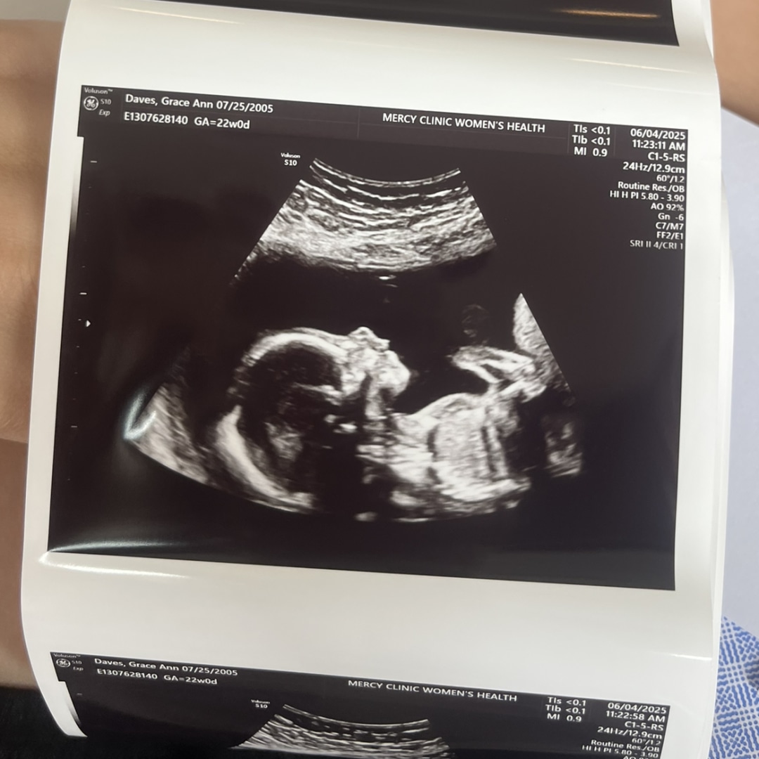 Photo shared by Grace for their Babylist baby registry.