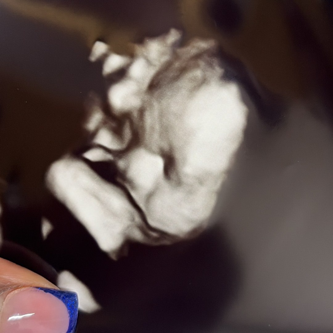 Photo shared by Samlisha for their Babylist baby registry.