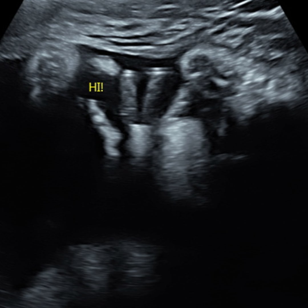 Photo shared by Elisha for their Babylist baby registry.
