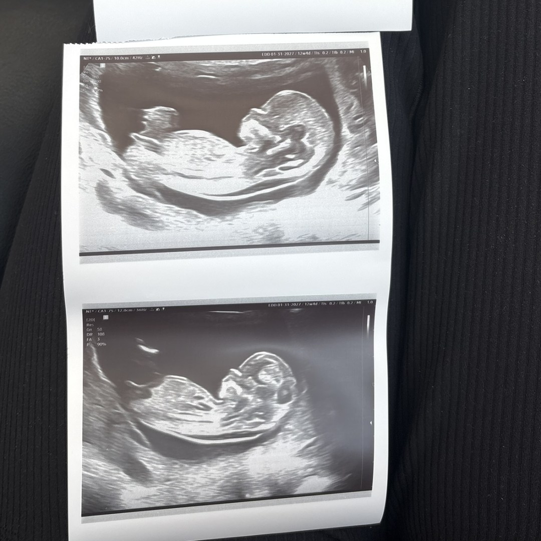Photo shared by Ella for their Babylist baby registry.