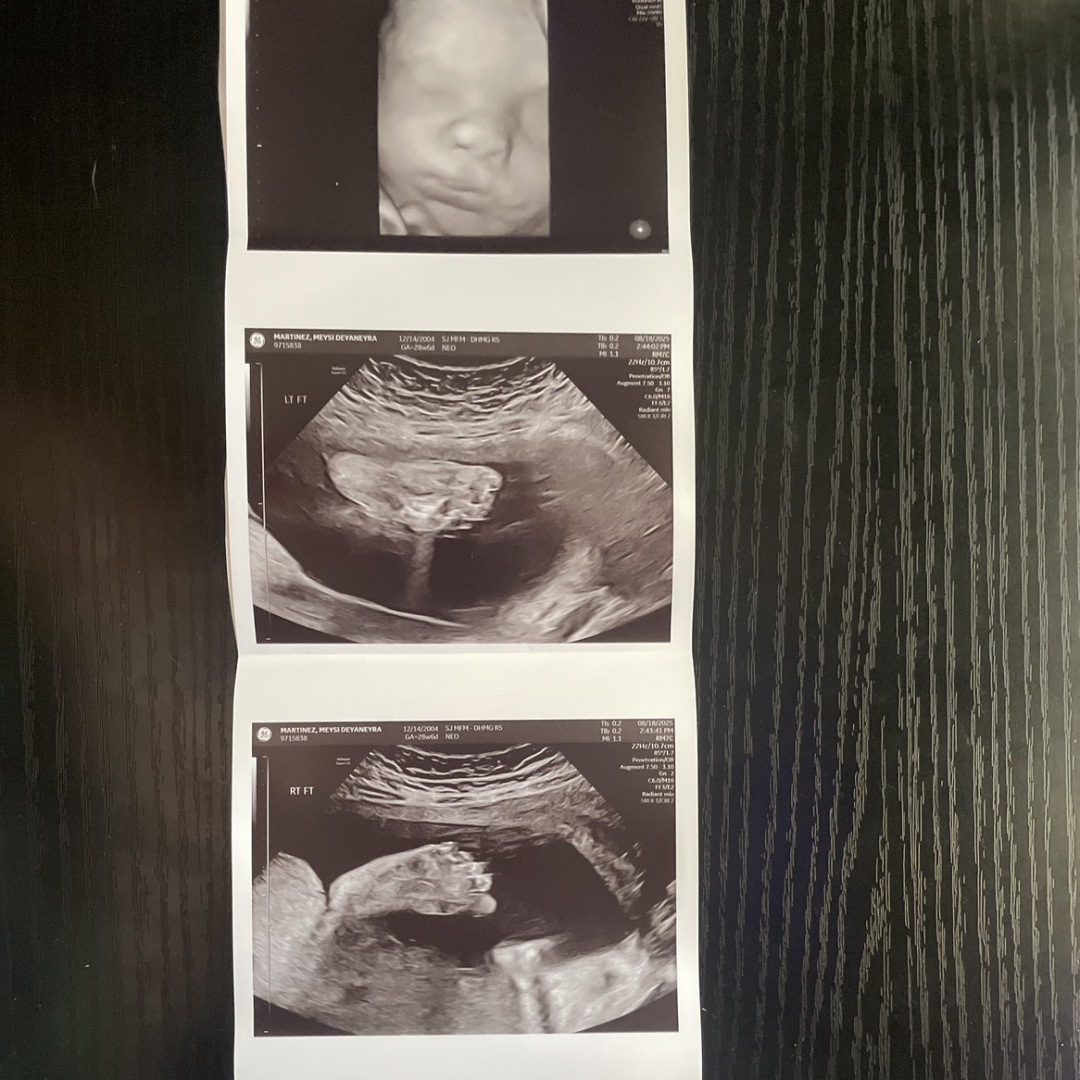 Photo shared by Meysi for their Babylist baby registry.