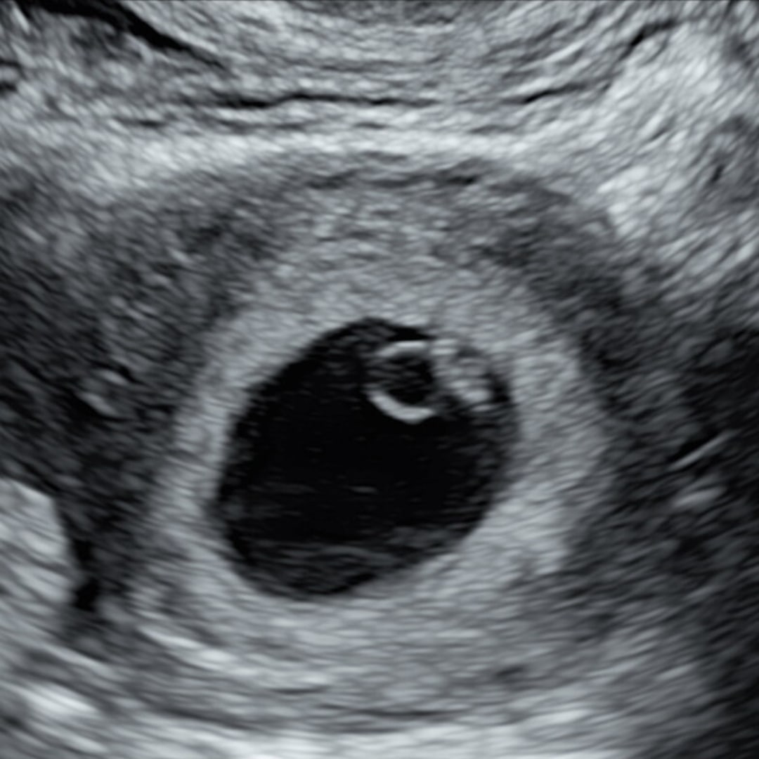 Photo shared by Lauren for their Babylist baby registry.