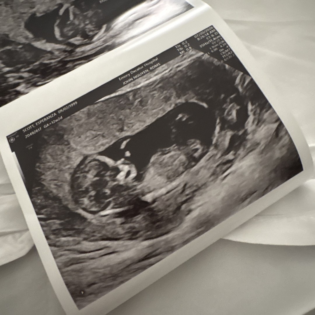 Photo shared by Esperanza for their Babylist baby registry.