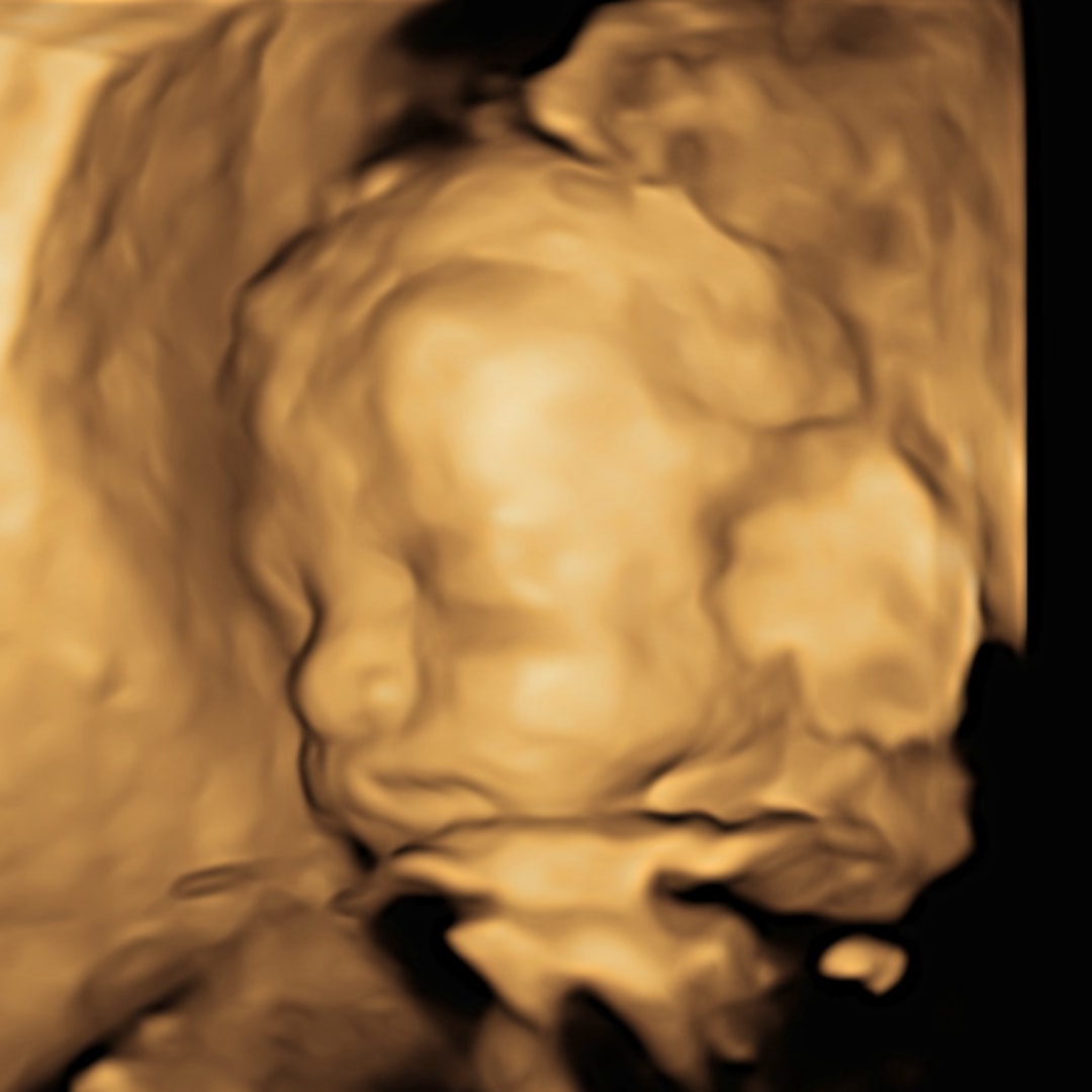 Photo shared by Cassidy for their Babylist baby registry.