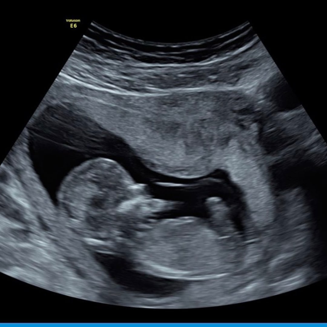 Photo shared by Savannah for their Babylist baby registry.