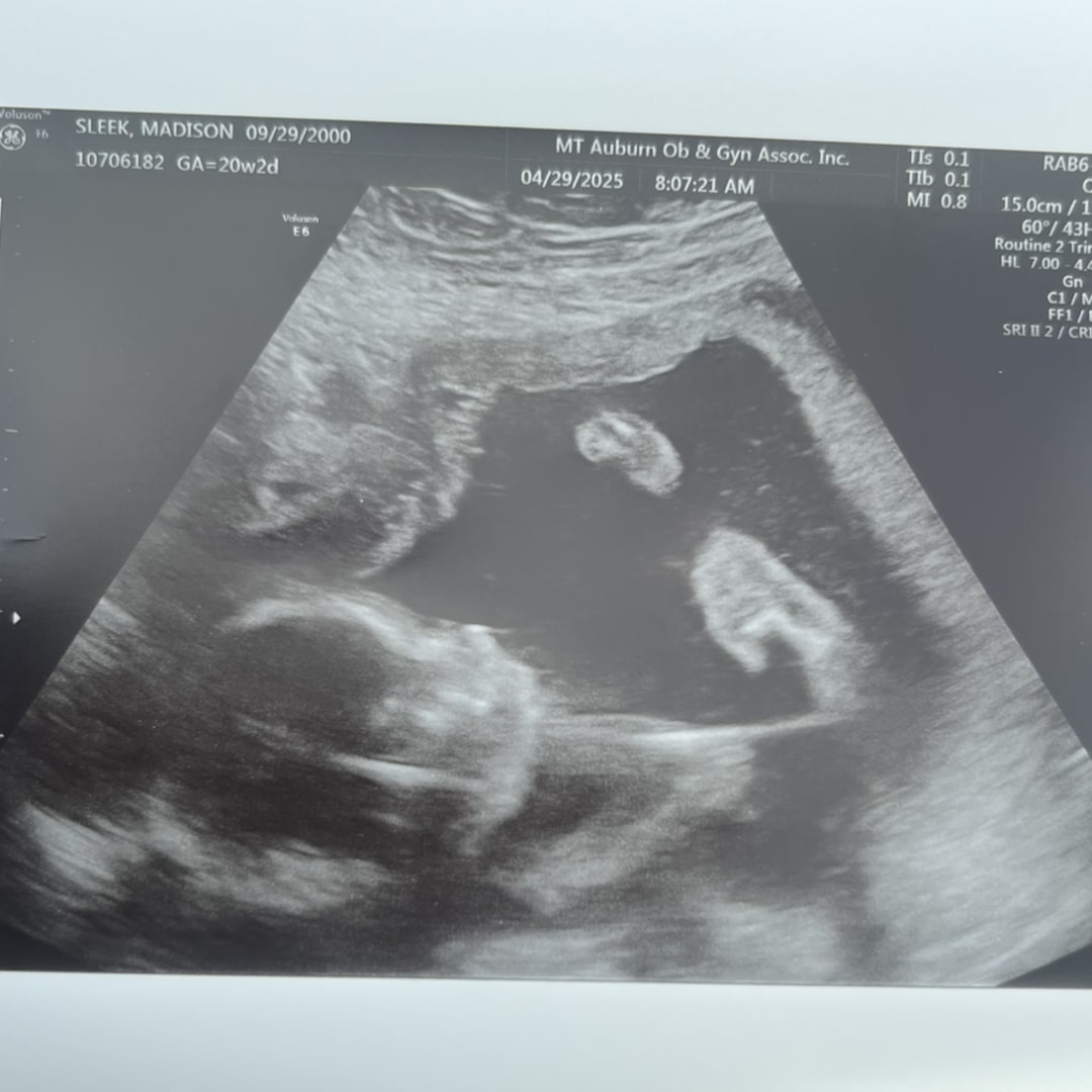Photo shared by Madison for their Babylist baby registry.