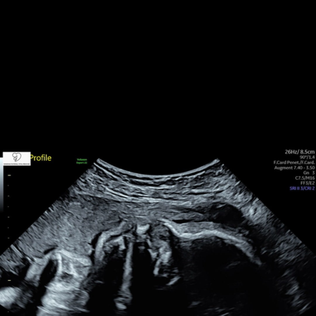 Photo shared by Andrea for their Babylist baby registry.