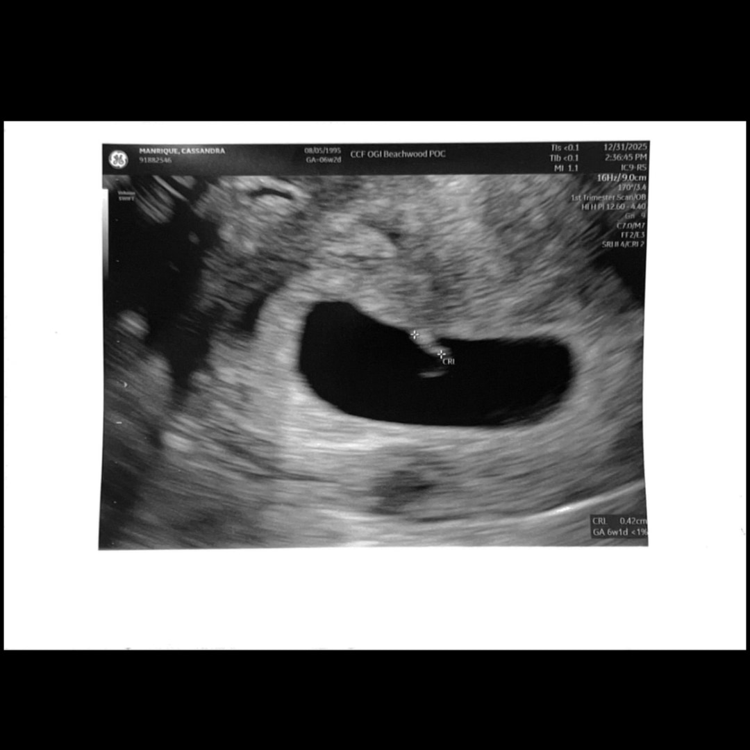 Photo shared by Randy for their Babylist baby registry.