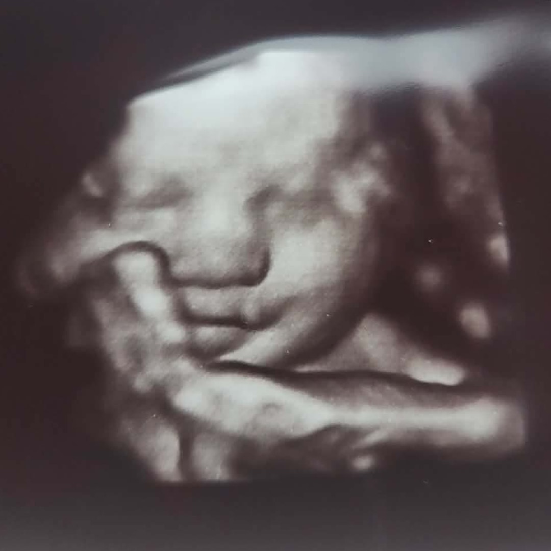 Photo shared by MacKenzie for their Babylist baby registry.