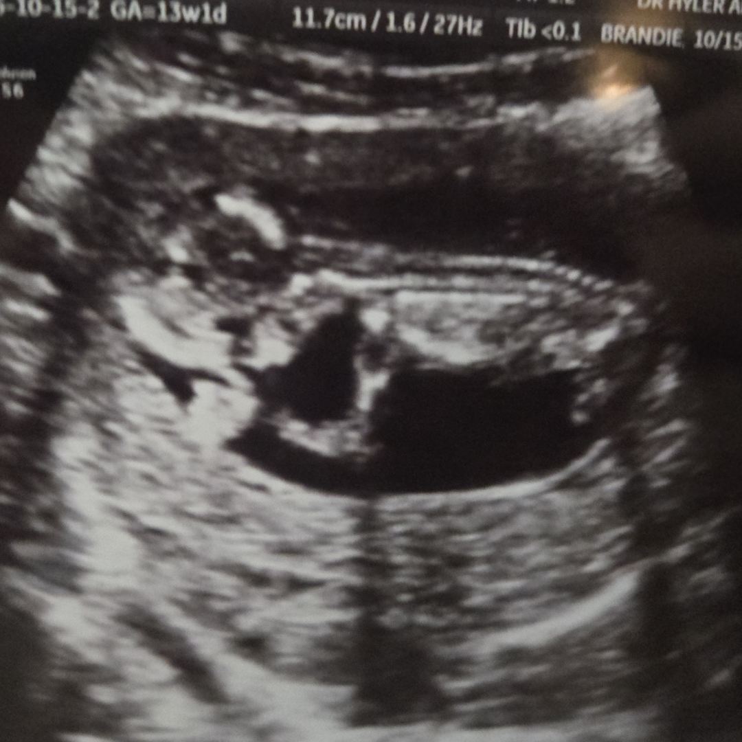 Photo shared by Katy for their Babylist baby registry.