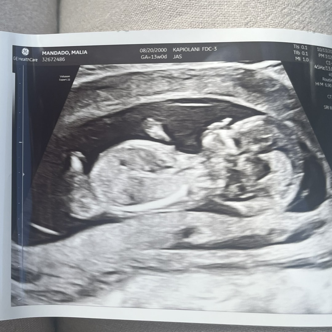 Photo shared by Cassey for their Babylist baby registry.