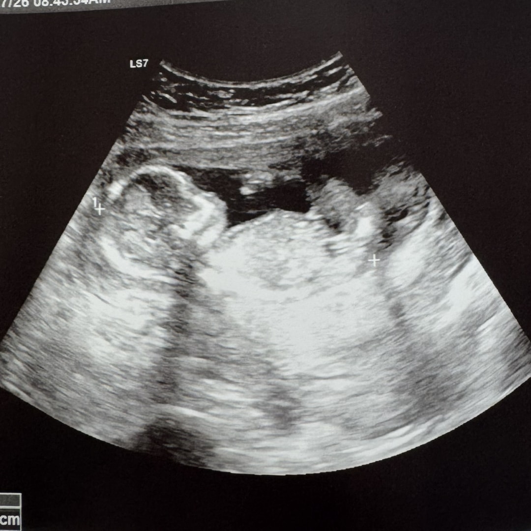 Photo shared by Julian for their Babylist baby registry.