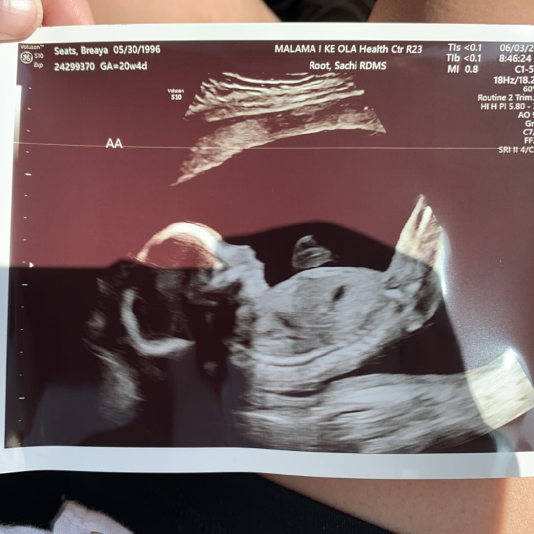 Photo shared by Breáya for their Babylist baby registry.