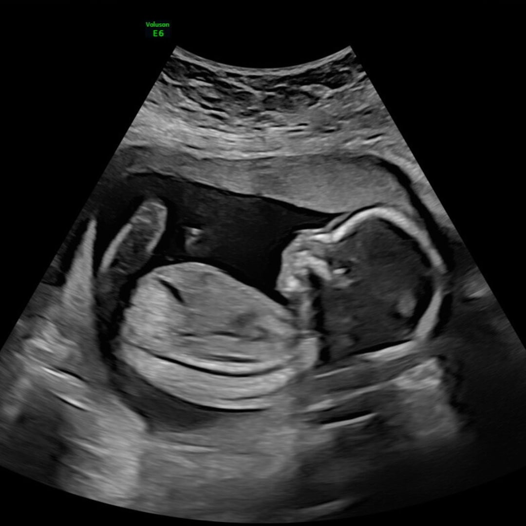 Photo shared by Amber for their Babylist baby registry.