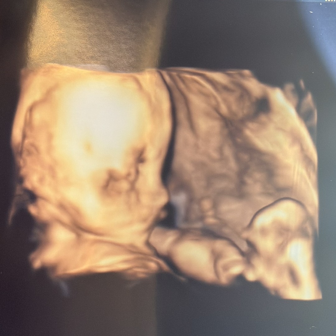 Photo shared by Darianne for their Babylist baby registry.