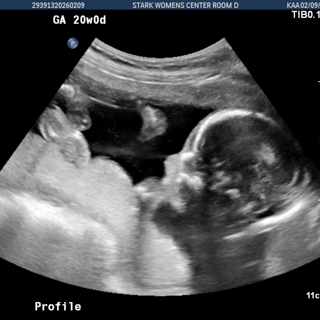 Photo shared by Ella for their Babylist baby registry.