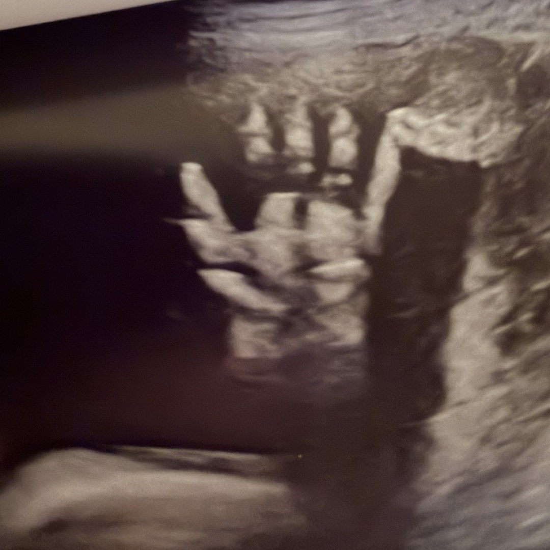 Photo shared by Hannah for their Babylist baby registry.