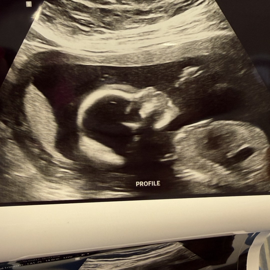 Photo shared by Brittany for their Babylist baby registry.