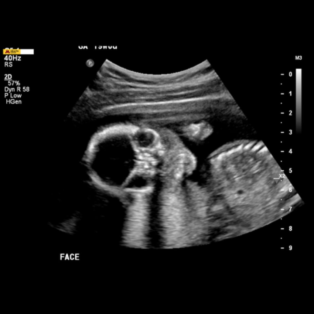 Photo shared by Ellie for their Babylist baby registry.