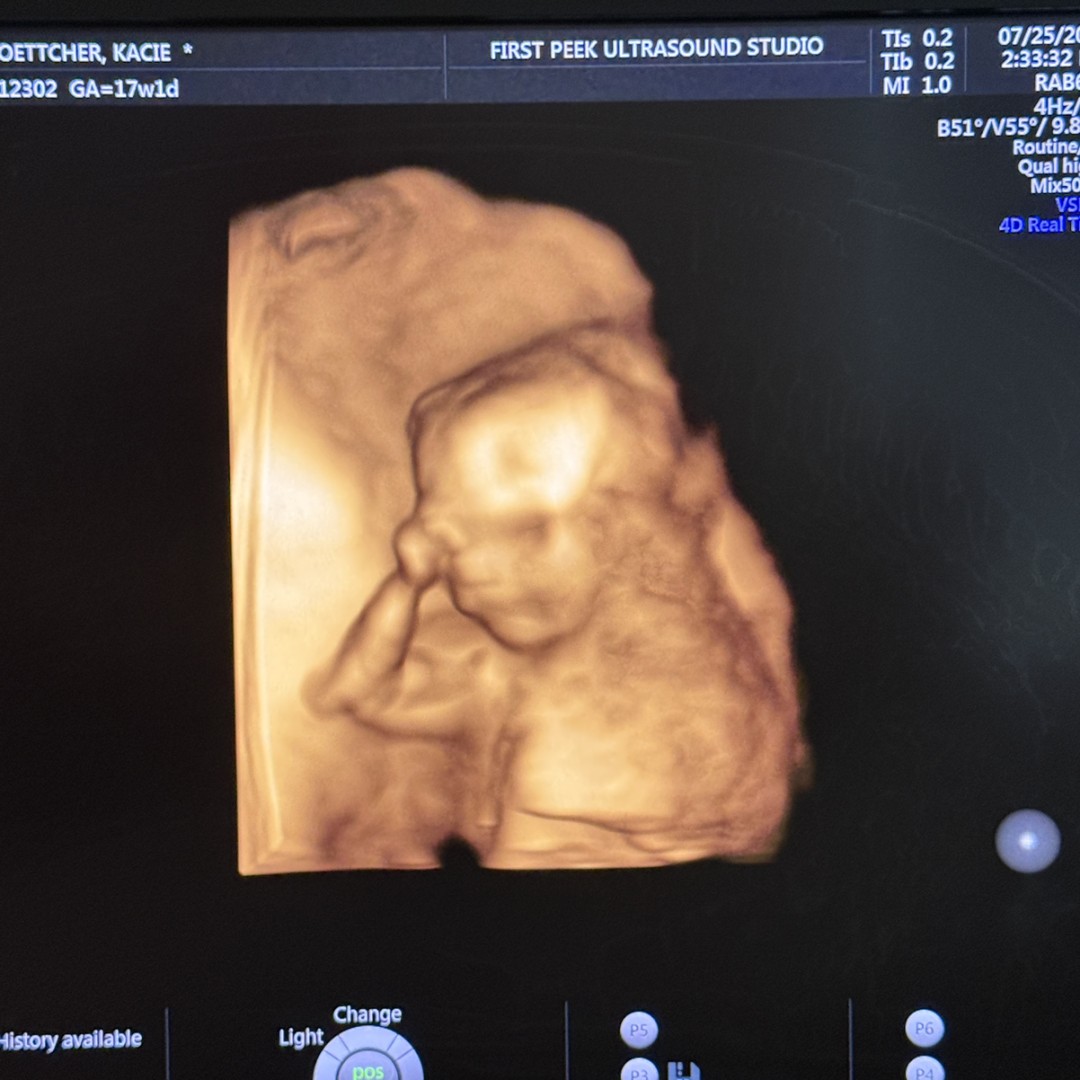 Photo shared by Kacie for their Babylist baby registry.