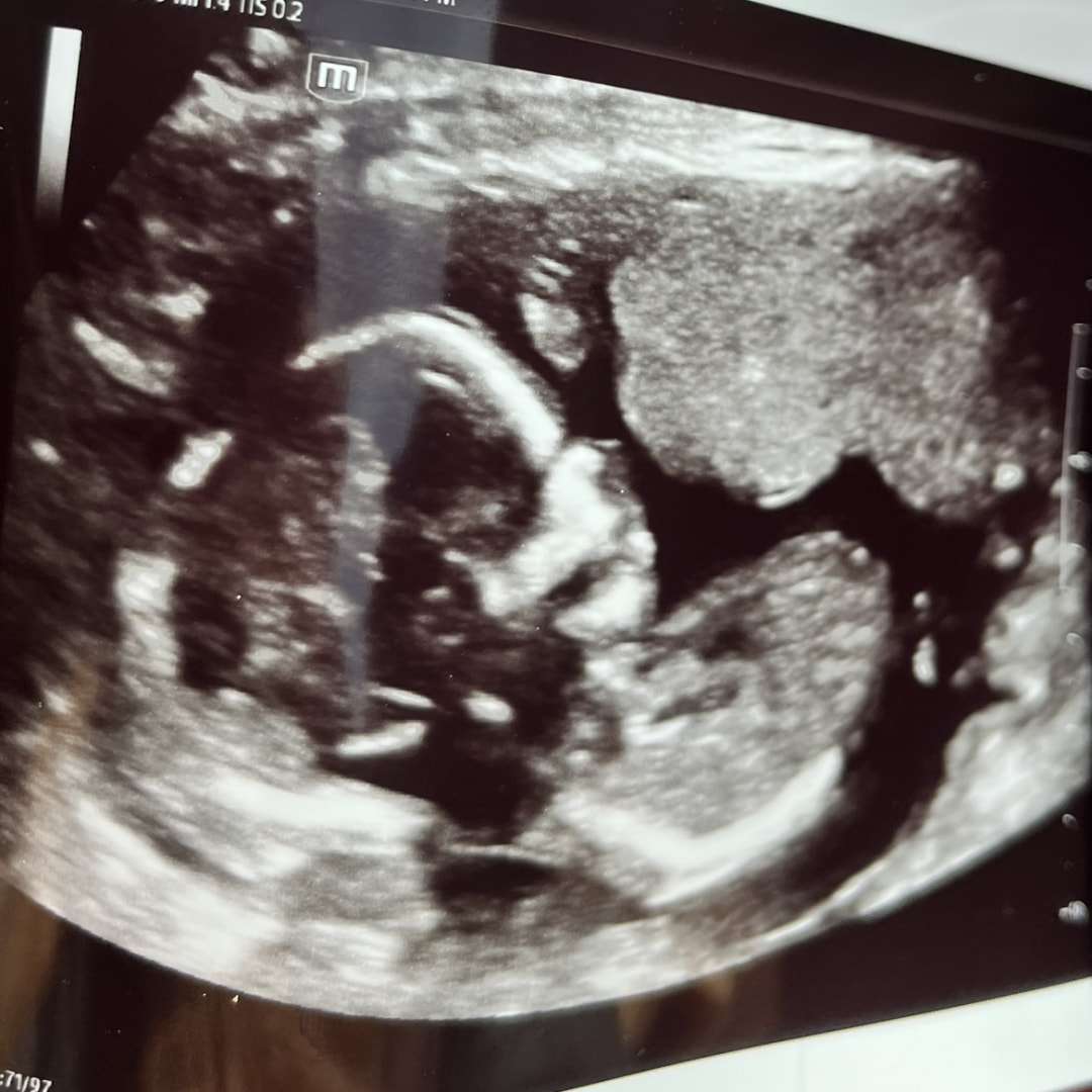Photo shared by Matilda for their Babylist baby registry.