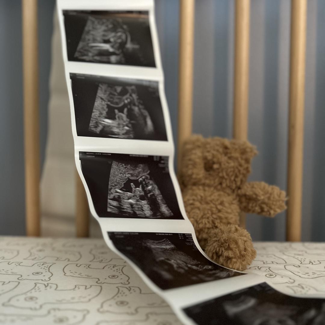 Photo shared by Lauren for their Babylist baby registry.