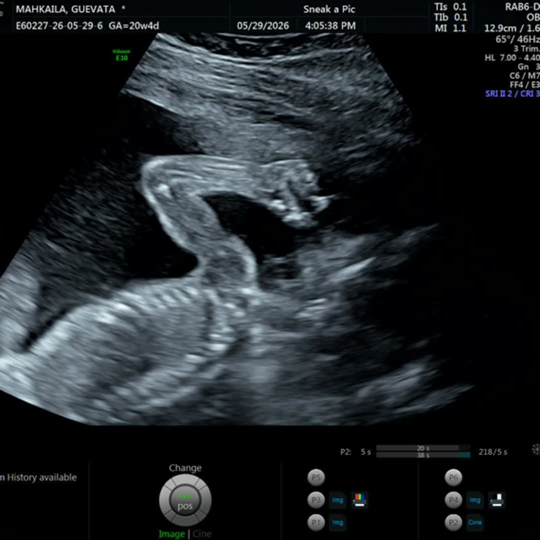Photo shared by Mahkaila for their Babylist baby registry.
