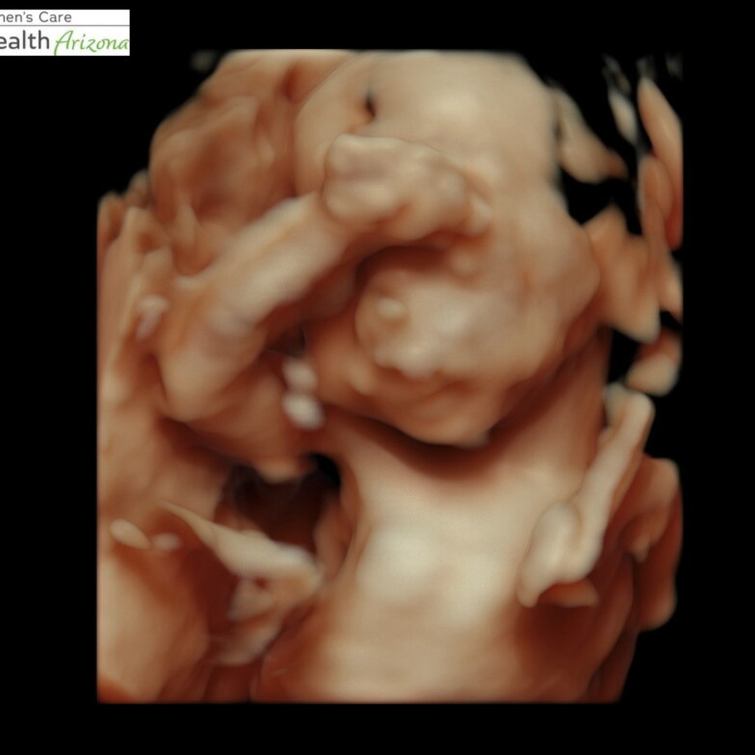 Photo shared by Valerie for their Babylist baby registry.