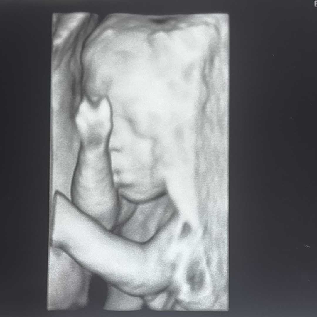 Photo shared by Skylar for their Babylist baby registry.