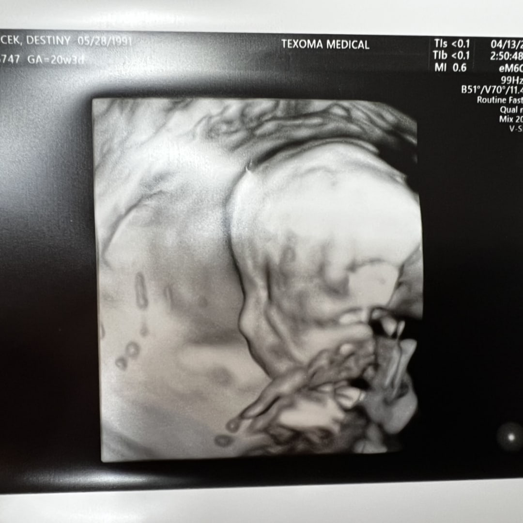 Photo shared by Destiny for their Babylist baby registry.