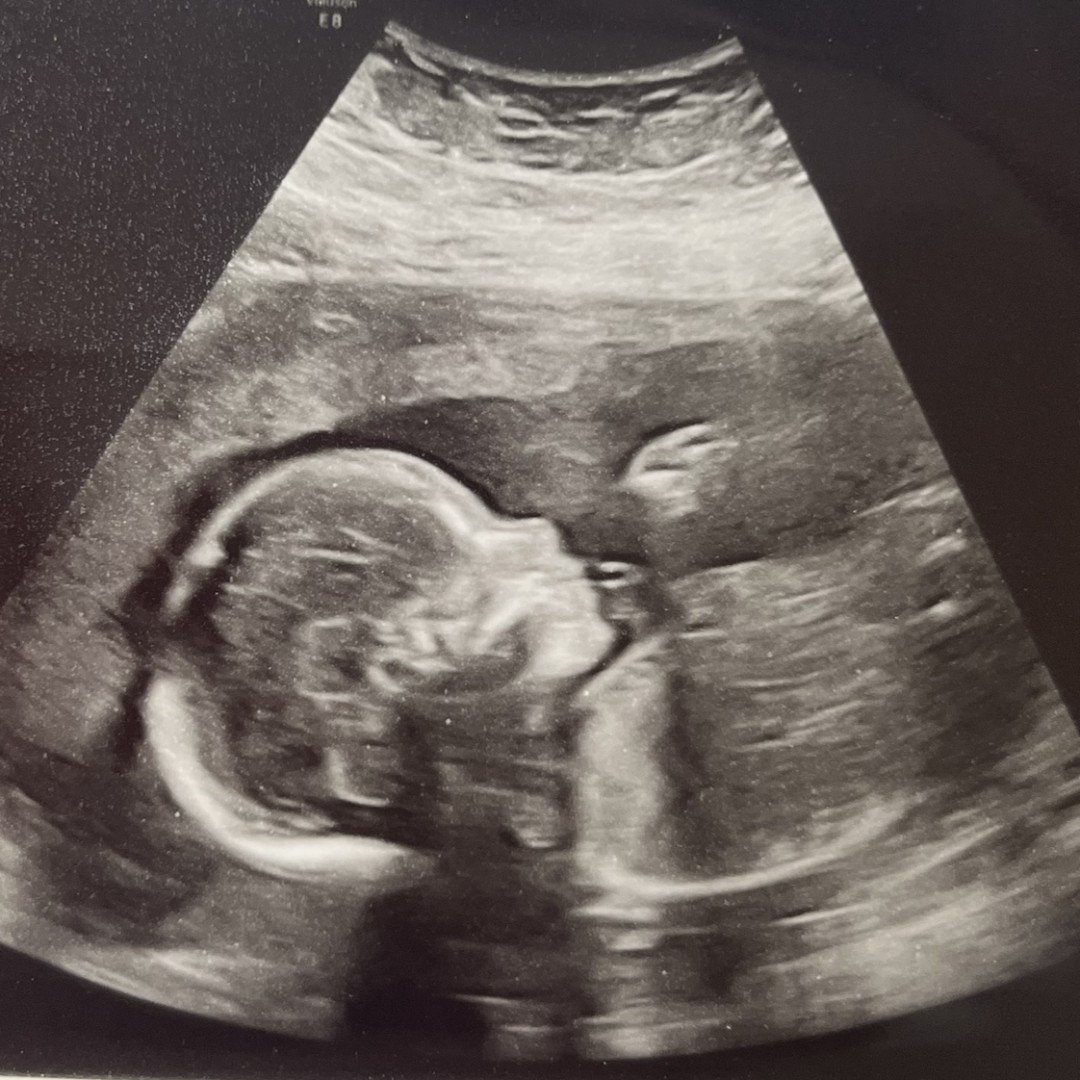 Photo shared by Shelby for their Babylist baby registry.