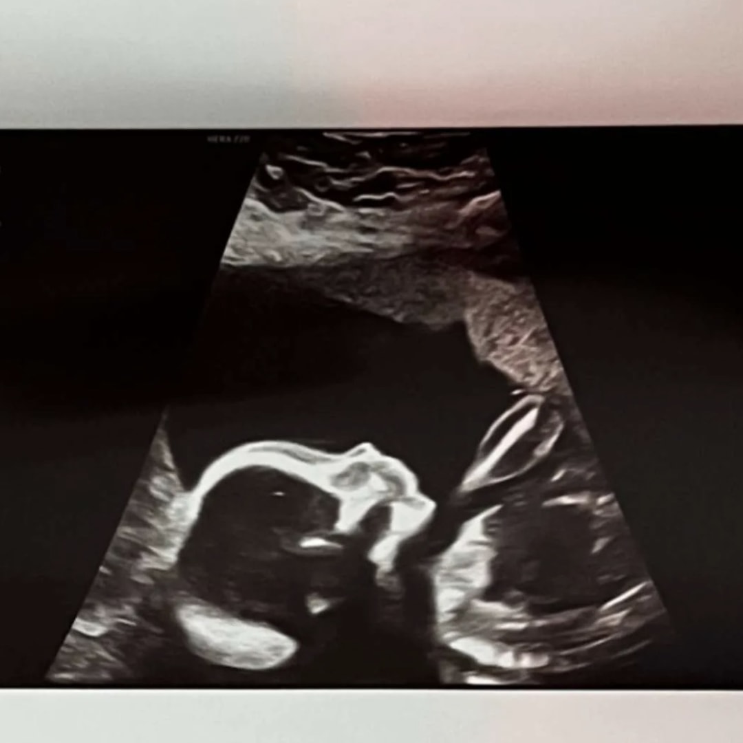 Photo shared by Rylee for their Babylist baby registry.