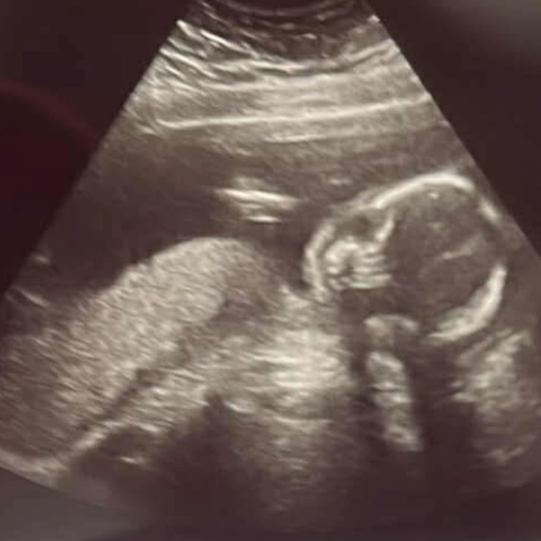 Photo shared by Ashley for their Babylist baby registry.