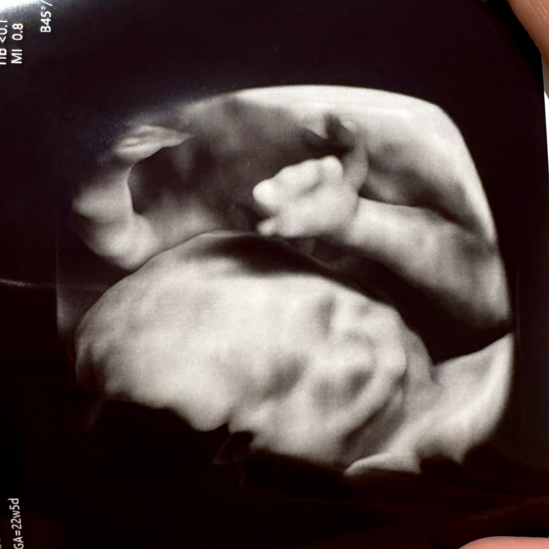 Photo shared by Amanda for their Babylist baby registry.