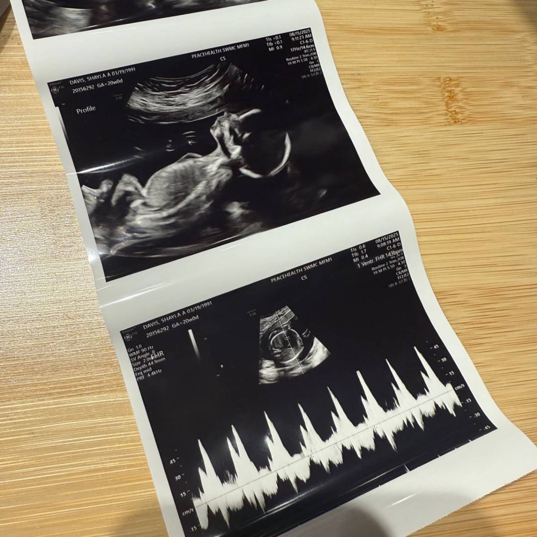 Photo shared by Shayla for their Babylist baby registry.
