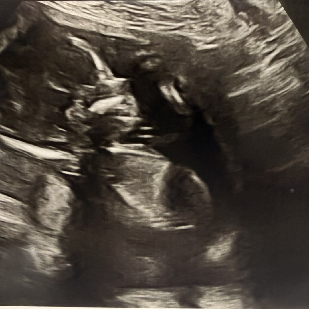 Photo shared by Naomi for their Babylist baby registry.