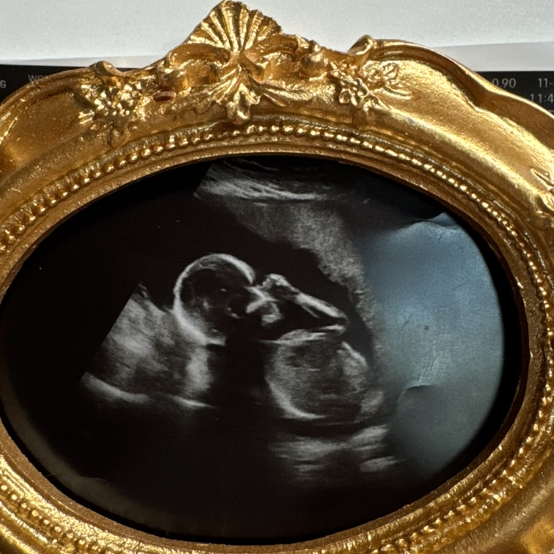 Photo shared by Alexis for their Babylist baby registry.