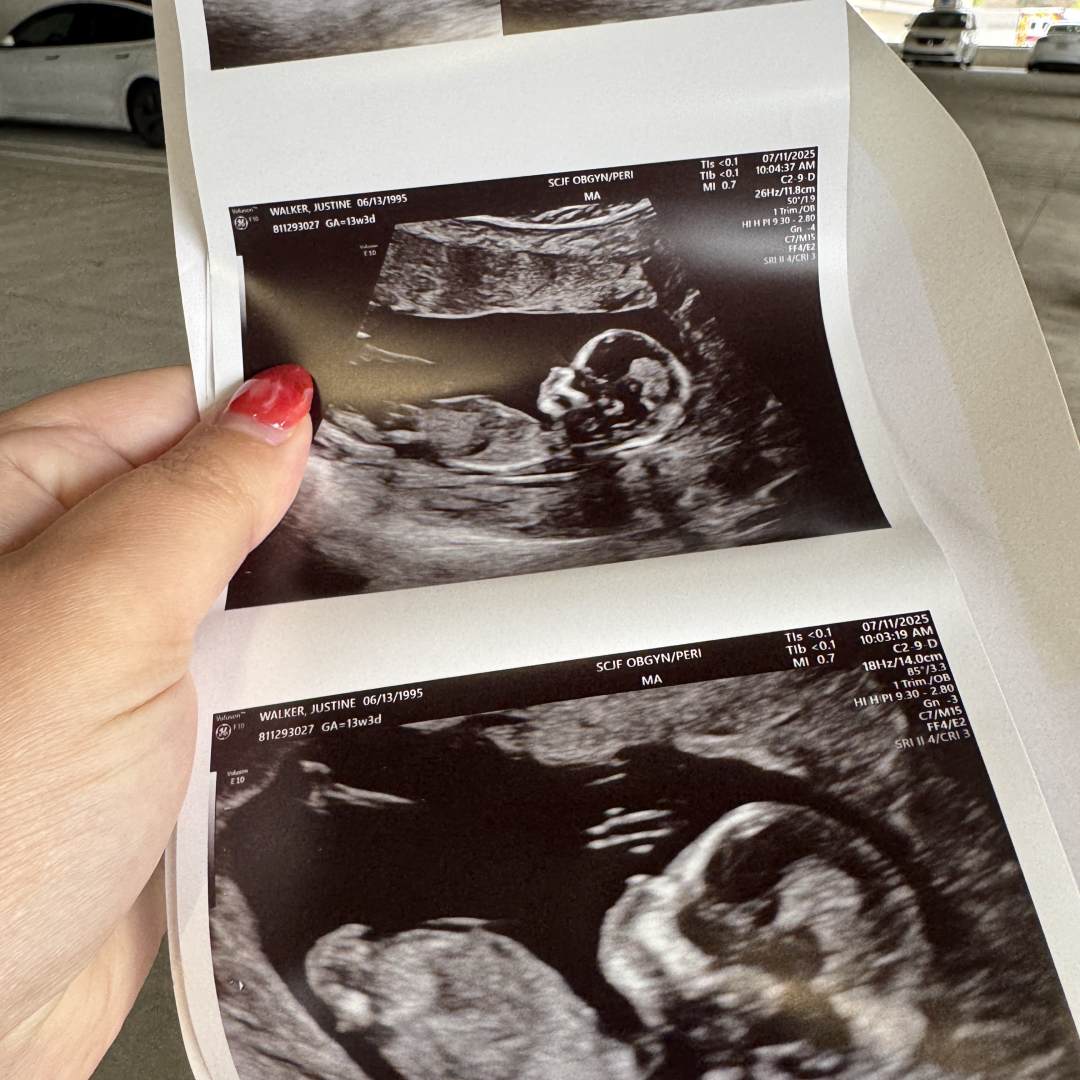 Photo shared by Justine for their Babylist baby registry.