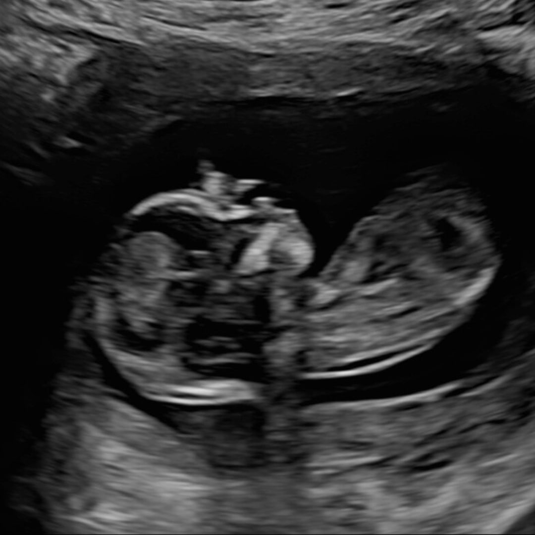 Photo shared by Josie for their Babylist baby registry.