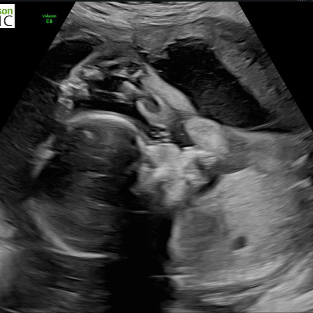 Photo shared by Shannon for their Babylist baby registry.