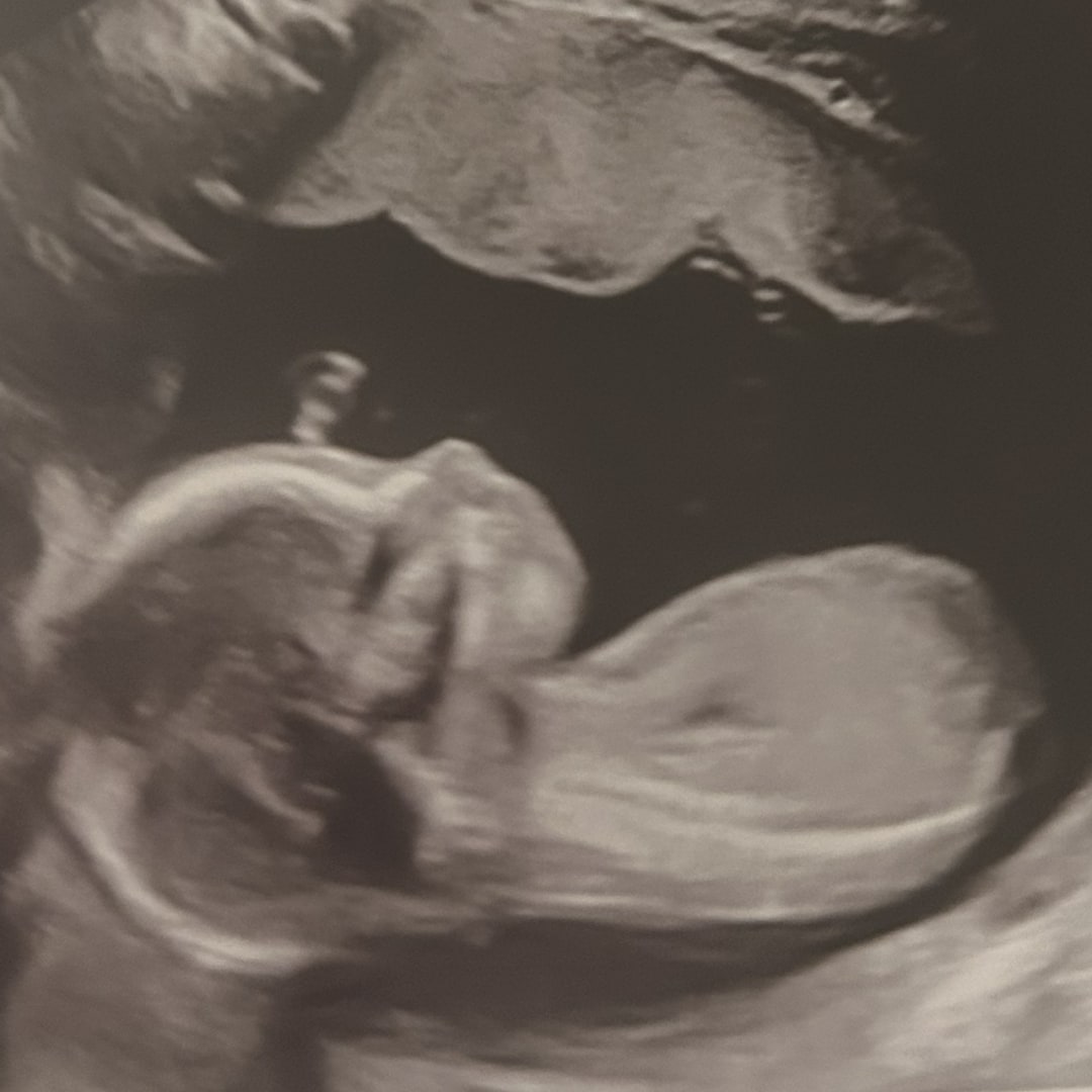 Photo shared by Claire for their Babylist baby registry.
