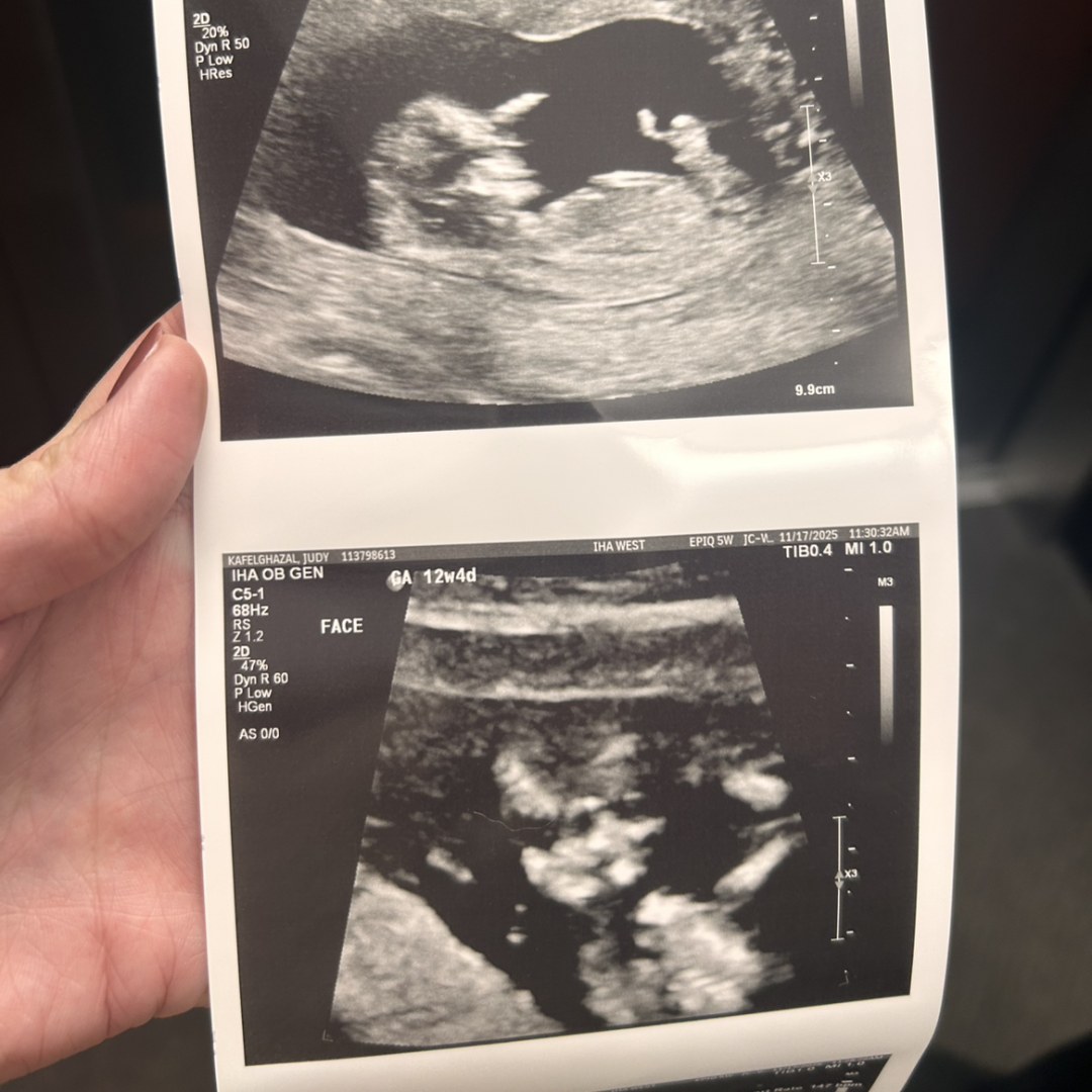 Photo shared by Judy for their Babylist baby registry.