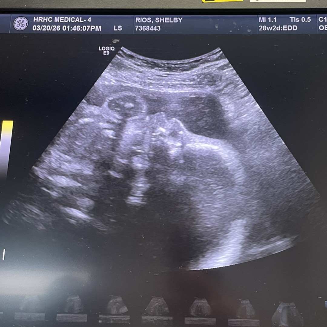 Photo shared by Shelby for their Babylist baby registry.