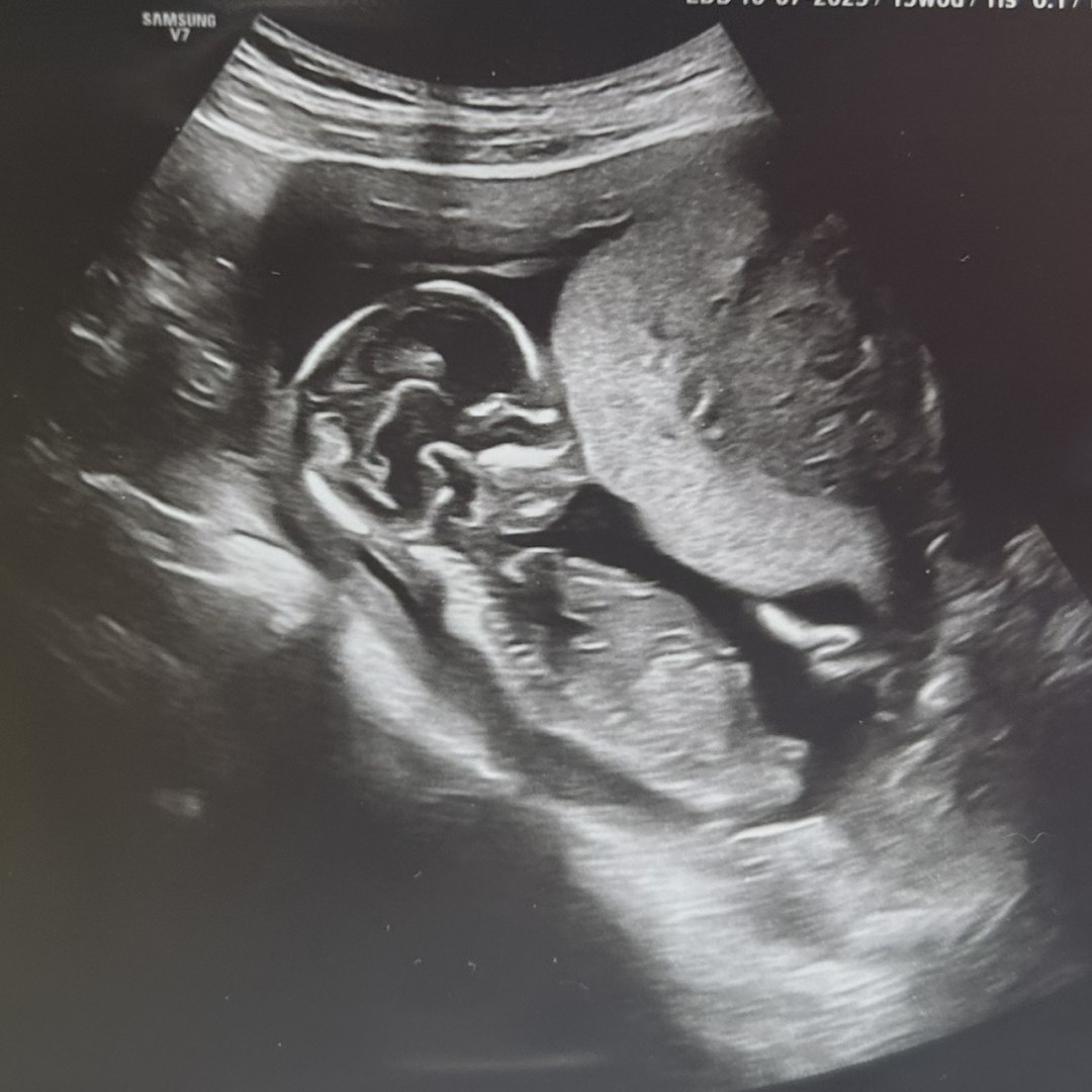 Photo shared by Kye for their Babylist baby registry.