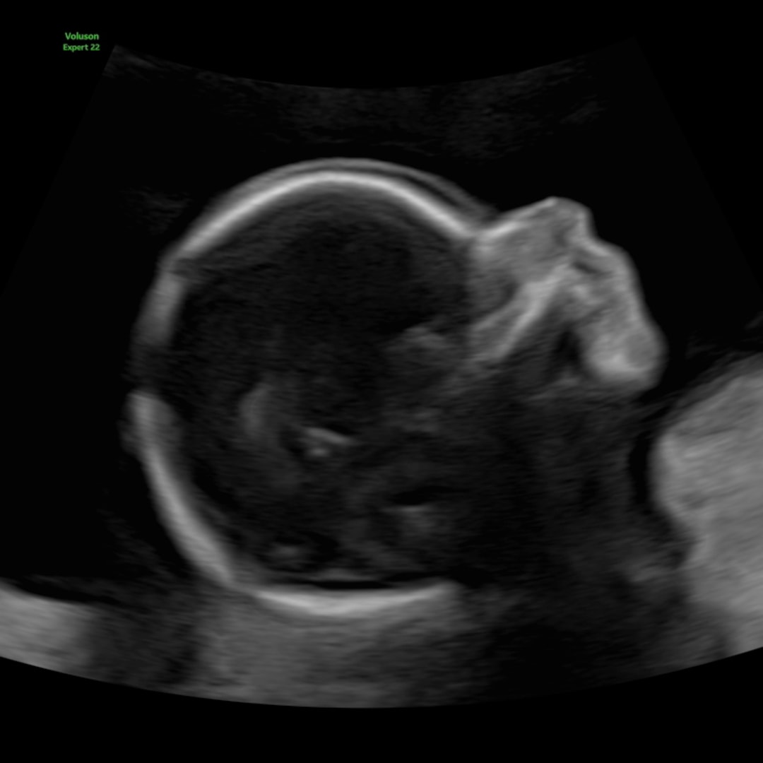 Photo shared by Cameron for their Babylist baby registry.