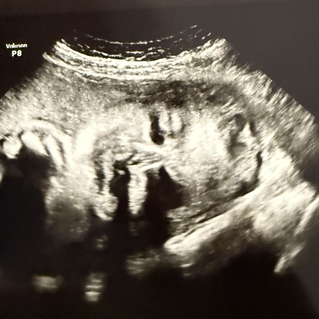 Photo shared by Priscilla for their Babylist baby registry.
