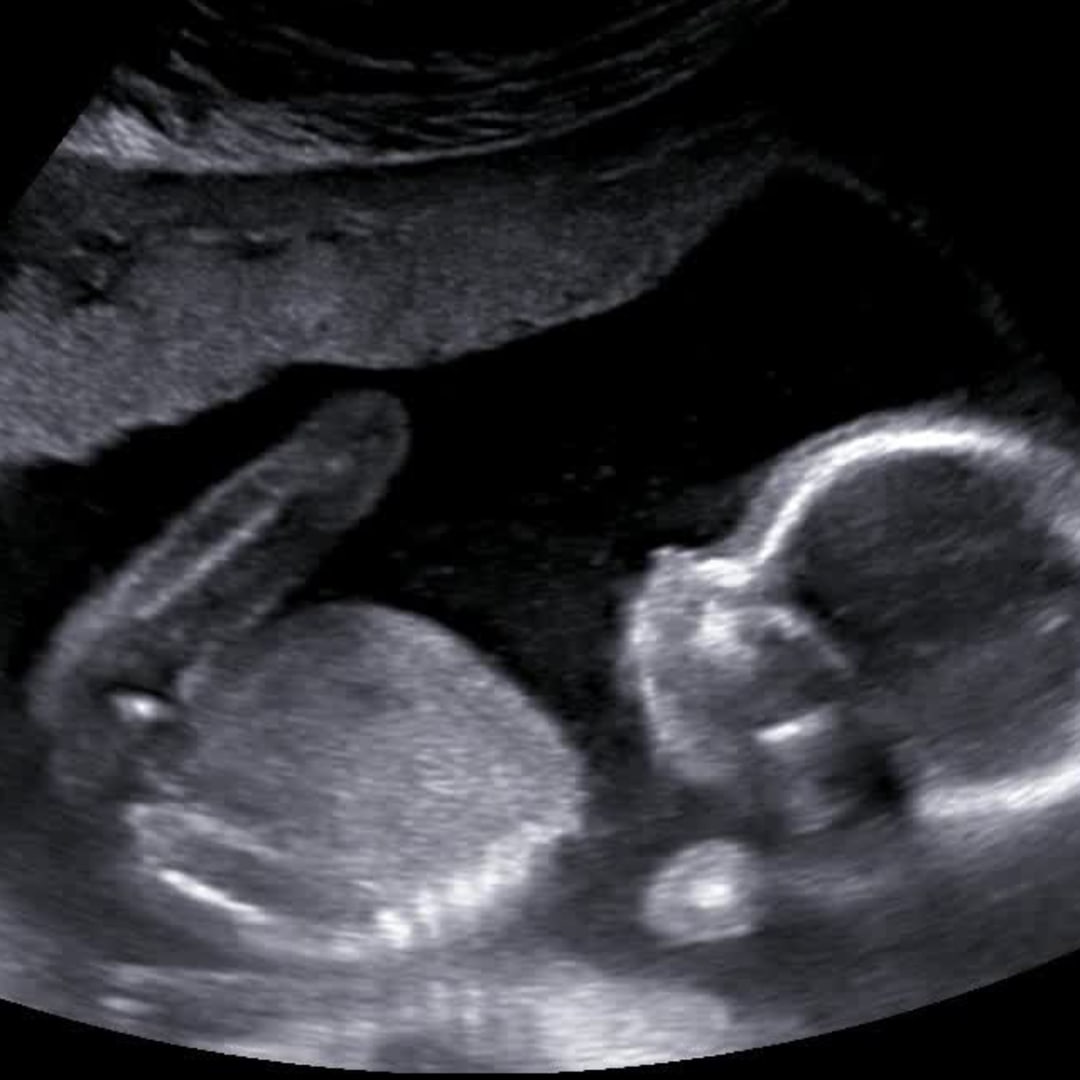 Photo shared by Lindsey for their Babylist baby registry.