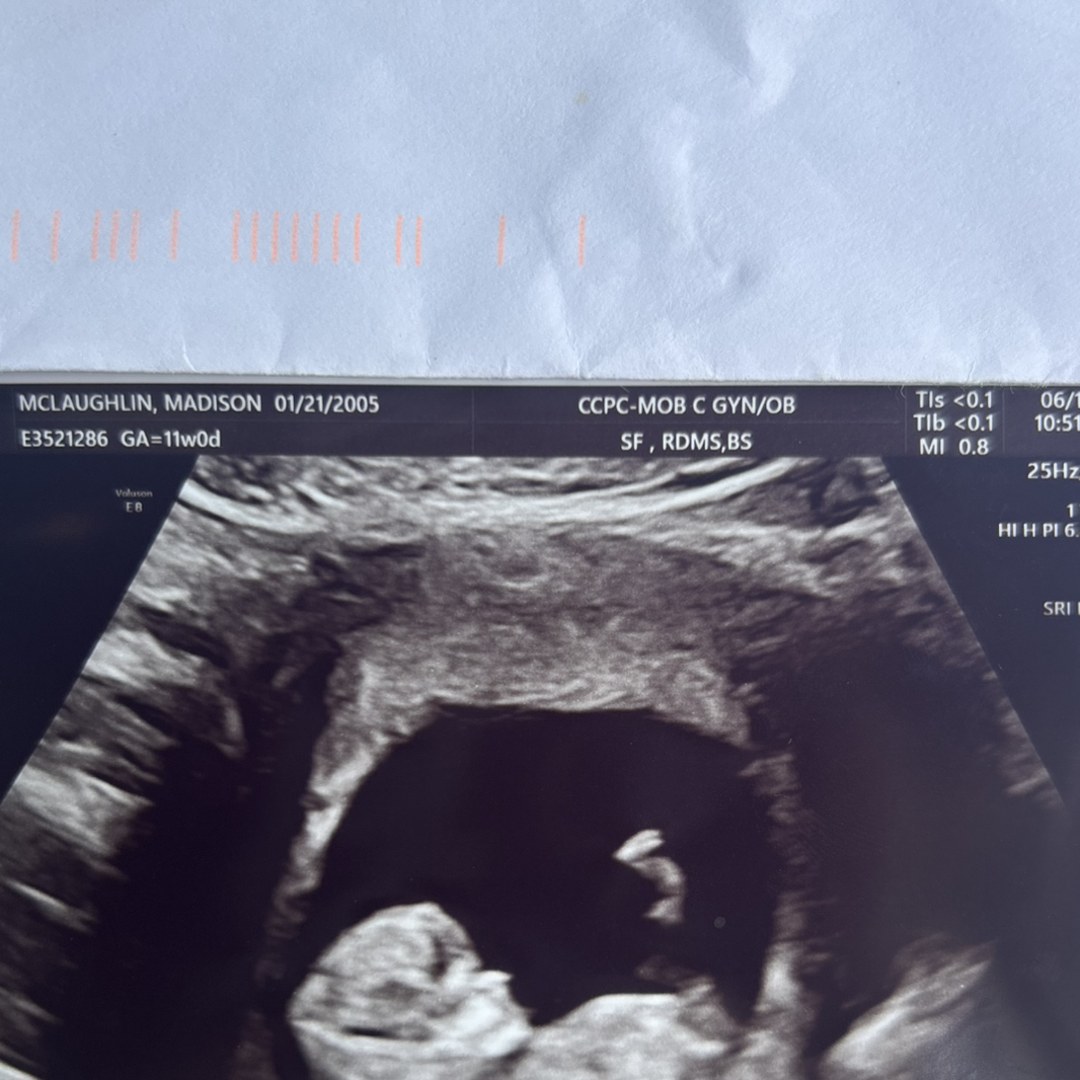 Photo shared by Maddy for their Babylist baby registry.
