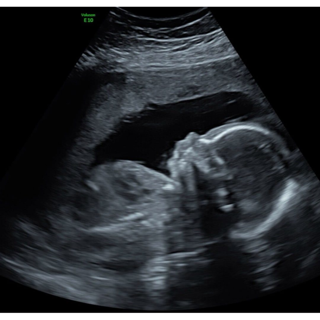 Photo shared by Melanie for their Babylist baby registry.