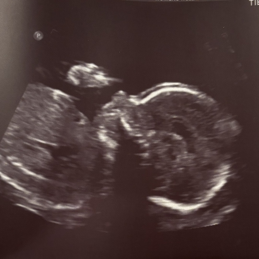 Photo shared by Zoe for their Babylist baby registry.